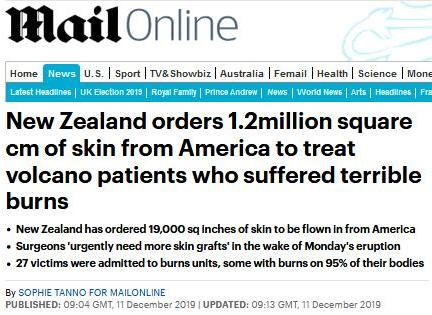 新西兰购120万平方厘米皮肤 火山喷发致数十人皮肤烧伤