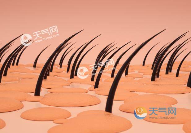 头皮屑头皮痒会传染给家人吗 头皮痒头皮屑多是什么原因