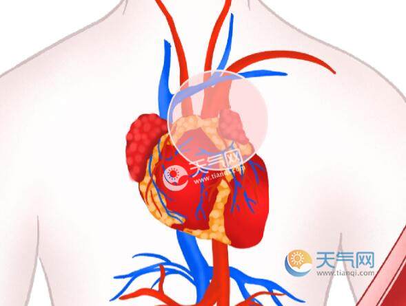 心梗是什么原因造成的 心梗症状前兆9大表现