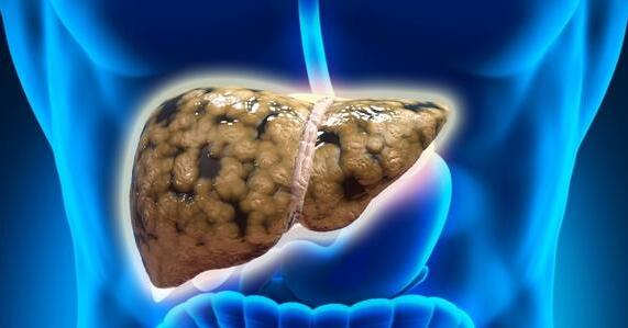 中国的脂肪肝人数超过2亿是什么情况 脂肪肝的症状有哪些表现