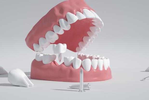 牙齿正畸只是为了好看吗 牙齿正畸和矫正有什么区别