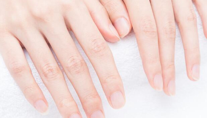 指甲上有竖纹是身体有大病的征兆吗 指甲上有竖纹是不是要得大病了