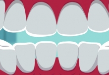 牙齿越白越健康是真的吗 正常的人的牙都很白吗
