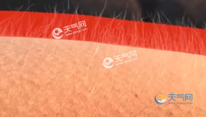 感到热却起鸡皮疙瘩(一热就起鸡皮疙瘩是怎么回事)